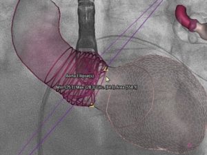 Diagnosis fluoroscopy